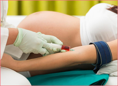 Gebelikte Kan Uyuşmazlığı