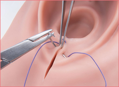 Vajina Daraltma Neden Yapılır?