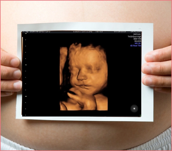 4 Boyutlu (4D) Ultrason Kaçıncı Haftada Yapılır?