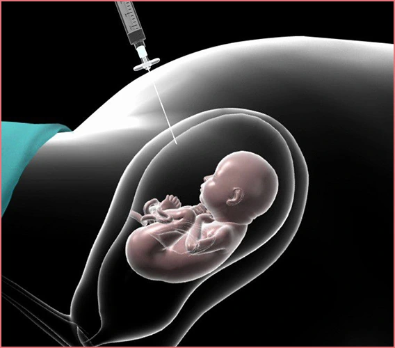 Amniyosentez sonrası doktorunuza bildirmeni gereken durumlar nelerdir?