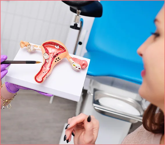 Polikistik Over Sendromu (PKOS)