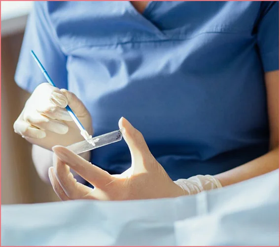 Smear testi sonucu nasıl değerlendirilir?