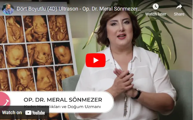 4 Boyutlu (4D) Ultrason nedir?